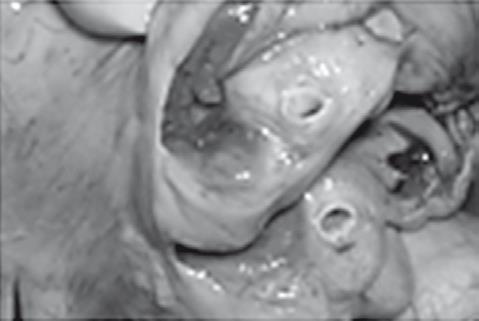 Иллюстрация к книге — Неалкогольная жировая болезнь печени [i_045.jpg]