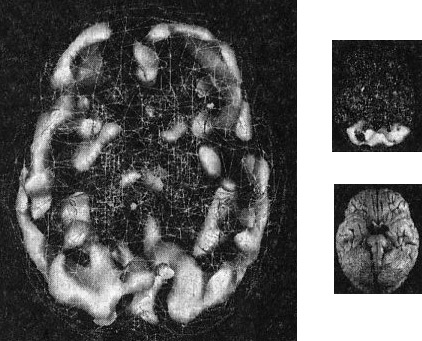 Иллюстрация к книге — Мозг. От хорошего к превосходному [img215copy.jpg]