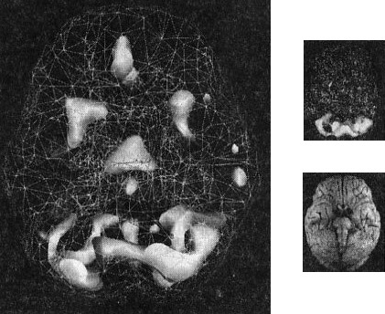Иллюстрация к книге — Мозг. От хорошего к превосходному [img216.jpg]