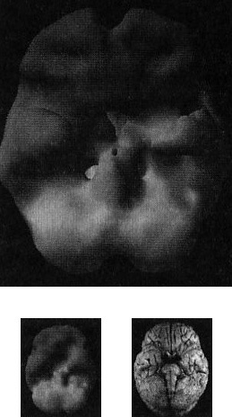 Иллюстрация к книге — Мозг. От хорошего к превосходному [img218copy.jpg]