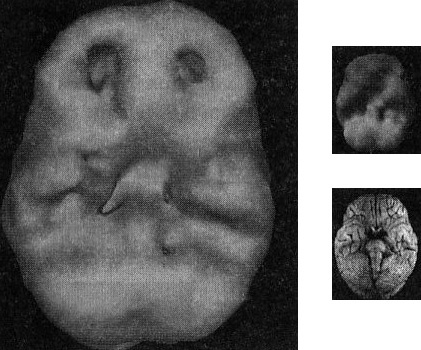 Иллюстрация к книге — Мозг. От хорошего к превосходному [img219.jpg]