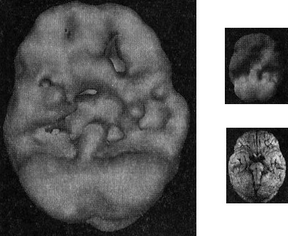 Иллюстрация к книге — Мозг. От хорошего к превосходному [img224.jpg]