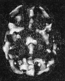 Иллюстрация к книге — Мозг. От хорошего к превосходному [img248.jpg]