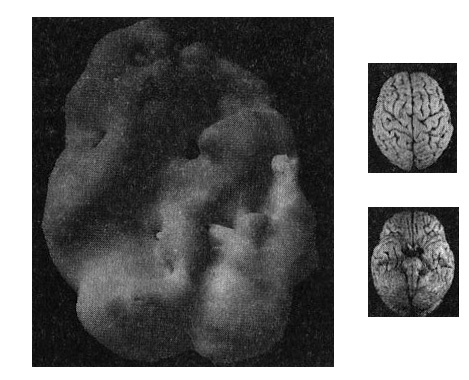 Иллюстрация к книге — Мозг. От хорошего к превосходному [img257.jpg]