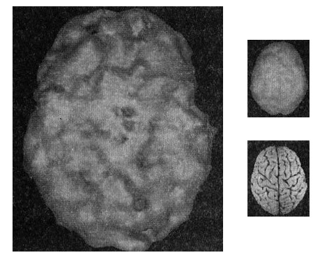 Иллюстрация к книге — Мозг. От хорошего к превосходному [img259.jpg]