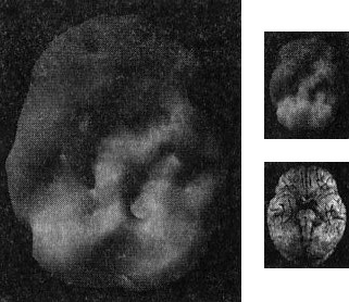 Иллюстрация к книге — Мозг. От хорошего к превосходному [img304copy.jpg]