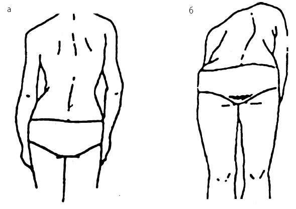 Иллюстрация к книге — Детский массаж. От рождения до 7 лет [i_025.jpg]