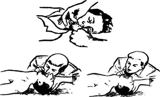 Иллюстрация к книге — Основы медицинских знаний и здорового образа жизни [_1_10.jpg]