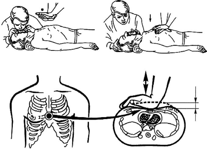 Иллюстрация к книге — Основы медицинских знаний и здорового образа жизни [_1_11.jpg]