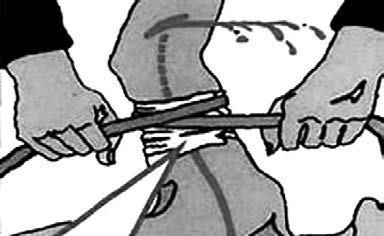 Иллюстрация к книге — Основы медицинских знаний и здорового образа жизни [_1_14.jpg]