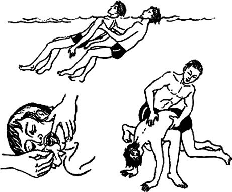 Иллюстрация к книге — Основы медицинских знаний и здорового образа жизни [_1_22.jpg]