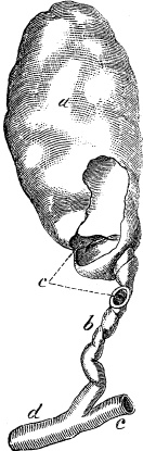 Иллюстрация к книге — Модицина. Encyclopedia Pathologica [_100.jpg]