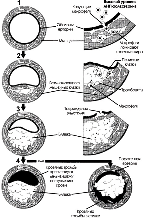 Иллюстрация к книге — Инсульт. Жизнь до и после [i_004.jpg]