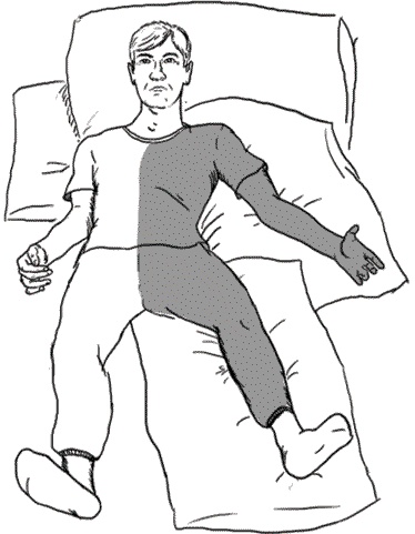 Иллюстрация к книге — Инсульт. Жизнь до и после [i_012.jpg]