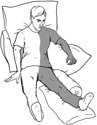 Иллюстрация к книге — Инсульт. Жизнь до и после [i_016.jpg]