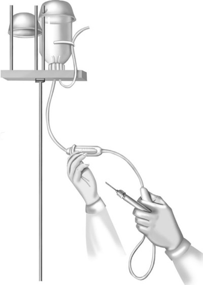 Иллюстрация к книге — Уколы, капельницы, перевязки и другие медицинские процедуры и манипуляции [i_013.jpg]