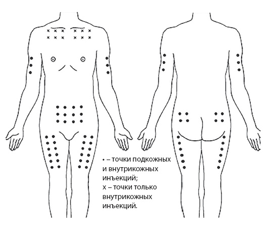 Иллюстрация к книге — Уколы, капельницы, перевязки и другие медицинские процедуры и манипуляции [i_014.jpg]
