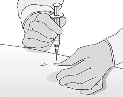 Иллюстрация к книге — Уколы, капельницы, перевязки и другие медицинские процедуры и манипуляции [i_016.jpg]