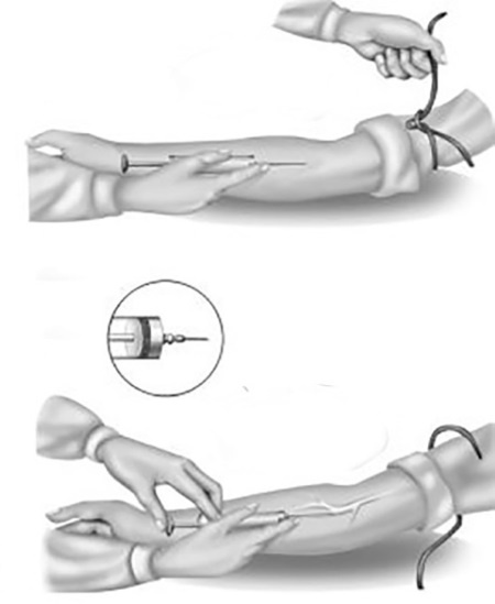 Иллюстрация к книге — Уколы, капельницы, перевязки и другие медицинские процедуры и манипуляции [i_019.jpg]