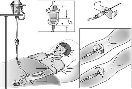 Иллюстрация к книге — Уколы, капельницы, перевязки и другие медицинские процедуры и манипуляции [i_020.jpg]