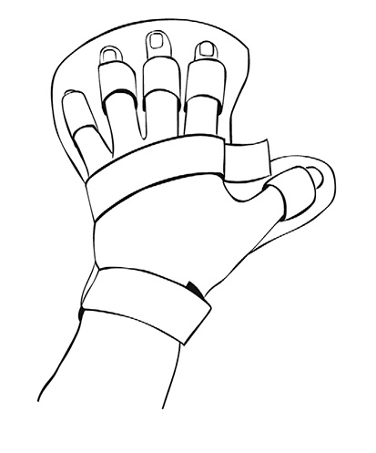 Иллюстрация к книге — Инсульт. До и после [i_016.jpg]