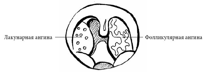 Иллюстрация к книге — Если ваш ребенок заболел. Что должны знать и уметь родители [i_011.jpg]