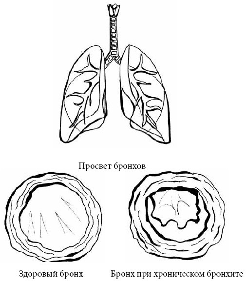 Иллюстрация к книге — Если ваш ребенок заболел. Что должны знать и уметь родители [i_016.jpg]