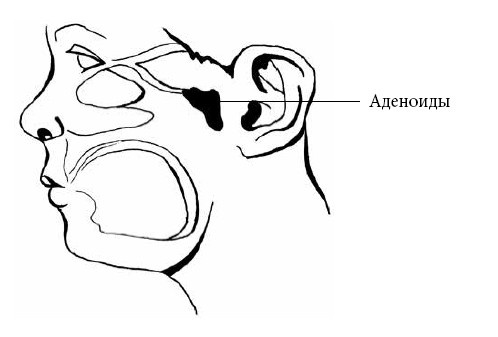 Иллюстрация к книге — Если ваш ребенок заболел. Что должны знать и уметь родители [i_021.jpg]