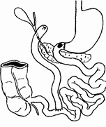 Иллюстрация к книге — Этюды желудочной хирургии [i_020.jpg]