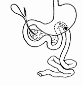 Иллюстрация к книге — Этюды желудочной хирургии [i_021.jpg]