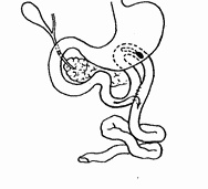 Иллюстрация к книге — Этюды желудочной хирургии [i_022.jpg]