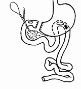 Иллюстрация к книге — Этюды желудочной хирургии [i_023.jpg]
