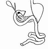 Иллюстрация к книге — Этюды желудочной хирургии [i_026.jpg]