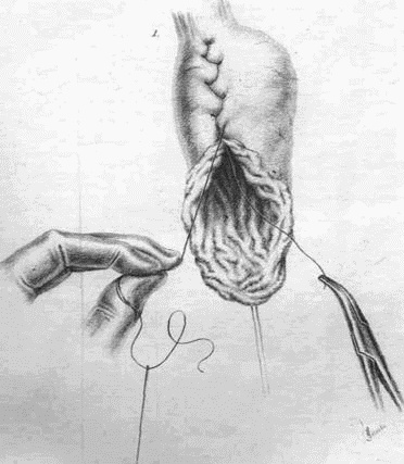 Иллюстрация к книге — Этюды желудочной хирургии [i_029.jpg]