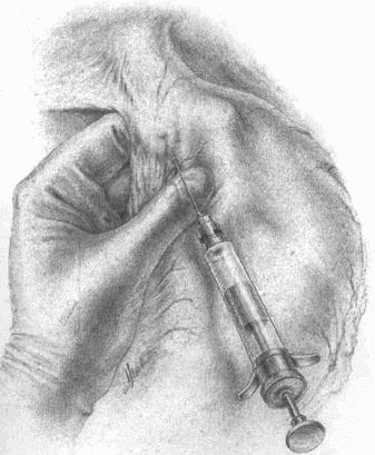 Иллюстрация к книге — Этюды желудочной хирургии [i_031.jpg]