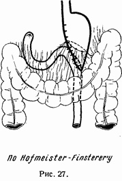 Иллюстрация к книге — Этюды желудочной хирургии [i_043.jpg]