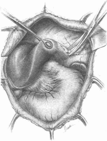 Иллюстрация к книге — Этюды желудочной хирургии [i_098.jpg]