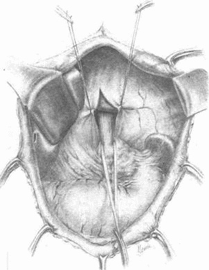 Иллюстрация к книге — Этюды желудочной хирургии [i_101.jpg]