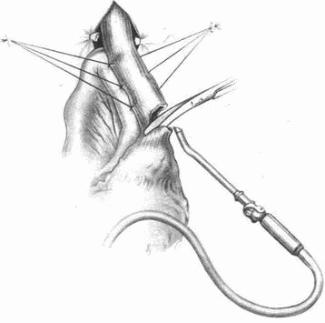 Иллюстрация к книге — Этюды желудочной хирургии [i_108.jpg]