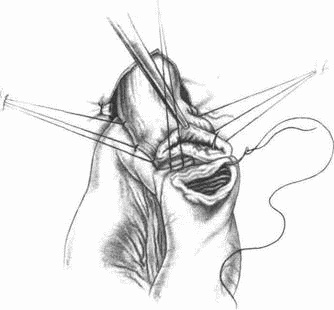 Иллюстрация к книге — Этюды желудочной хирургии [i_110.jpg]