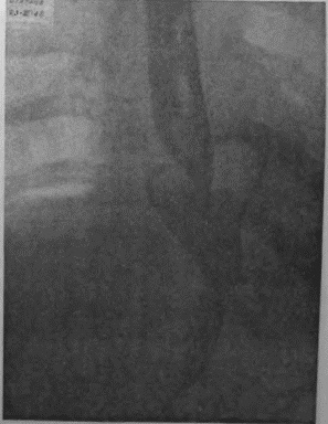 Иллюстрация к книге — Этюды желудочной хирургии [i_122.jpg]