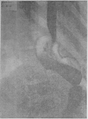 Иллюстрация к книге — Этюды желудочной хирургии [i_123.jpg]