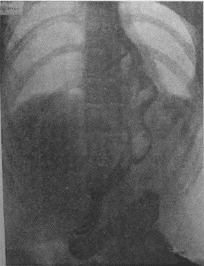 Иллюстрация к книге — Этюды желудочной хирургии [i_125.jpg]