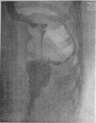 Иллюстрация к книге — Этюды желудочной хирургии [i_127.jpg]