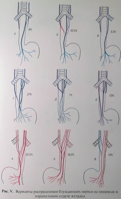 Иллюстрация к книге — Этюды желудочной хирургии [i_133.jpg]