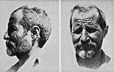 Иллюстрация к книге — Расы Европы [_227.jpg]