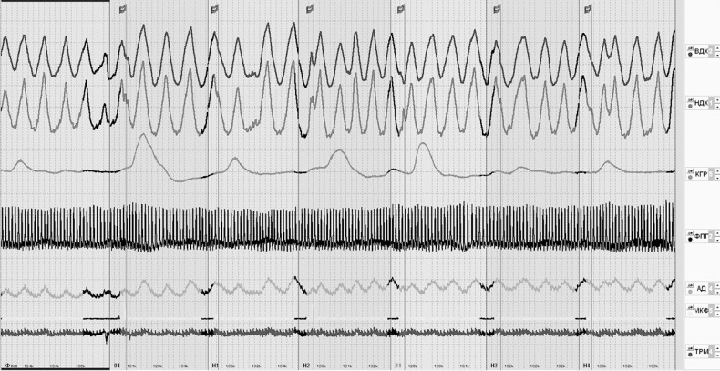 Иллюстрация к книге — Чердак. Только физика, только хардкор [i_098.jpg]