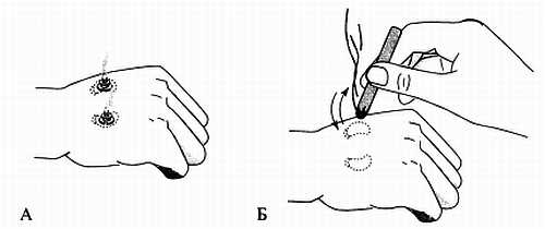 Иллюстрация к книге — Сам себе Су Джок доктор [_131.jpg]