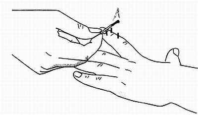 Иллюстрация к книге — Сам себе Су Джок доктор [_51.jpg]