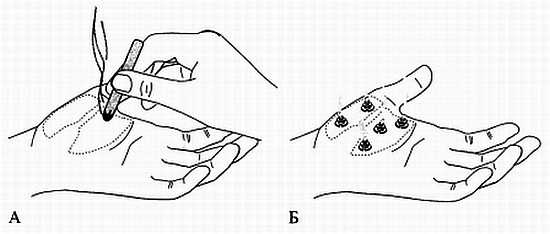 Иллюстрация к книге — Сам себе Су Джок доктор [_75.jpg]